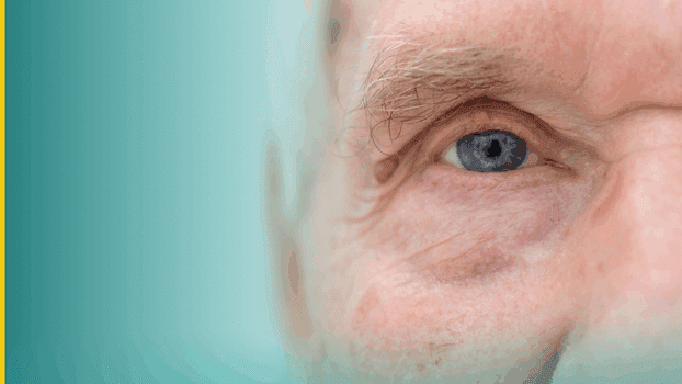 Identificar problemas de visão pode evitar danos irreversíveis