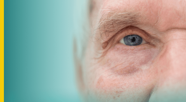 Identificar problemas de visão pode evitar danos irreversíveis